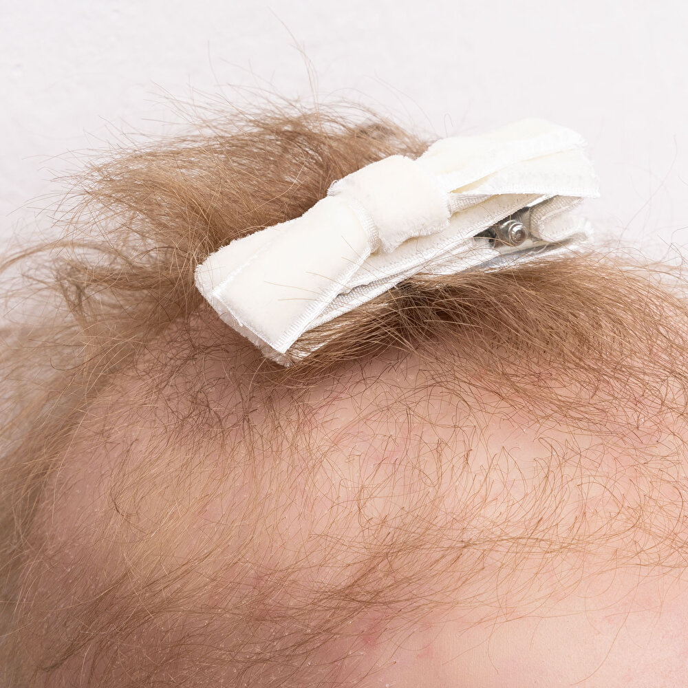 Kız Bebek Pixy Love Toka